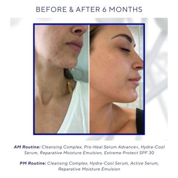 Active Serum
