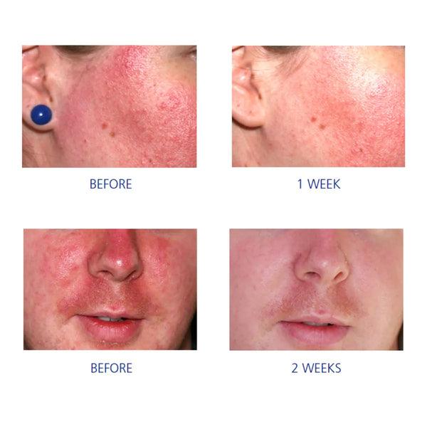 Pro-Heal Serum Advanced +