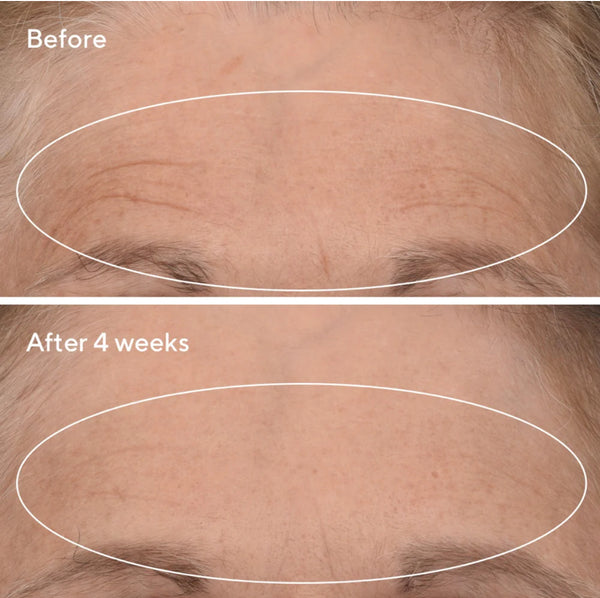 Retinal ReSulpt Overnight Treatment.